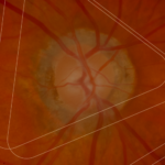 How do in vivo models in retinal research bridge pathophysiology and translational development?