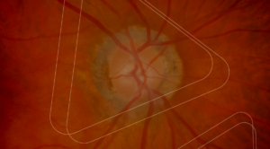 How do in vivo models in retinal research bridge pathophysiology and translational development?