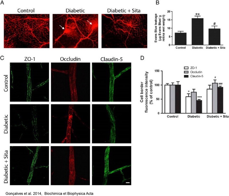 Diabetic retinopathy case study: evaluating retinal damage and therapeutic responses in preclinical models