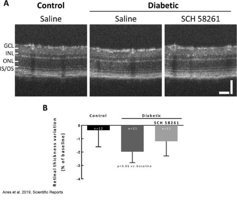 Diabetic retinopathy case study: evaluating retinal damage and therapeutic responses in preclinical models