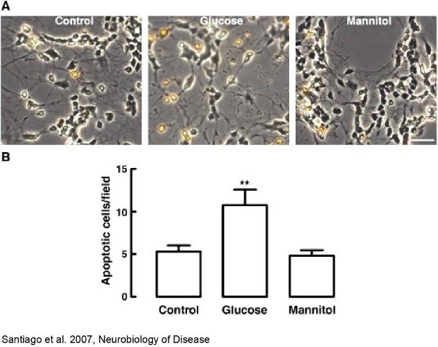 Diabetic retinopathy case study: evaluating retinal damage and therapeutic responses in preclinical models
